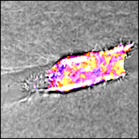 Vanderbilt University