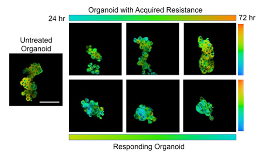 Organoid Tissue Dish Cancer