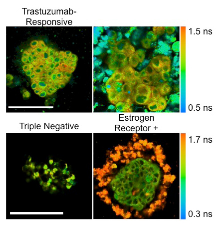Organoids Tumor Dish
