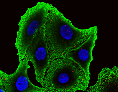 Vanderbilt University