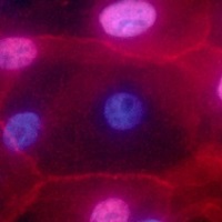 Vanderbilt University