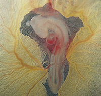 Vanderbilt University