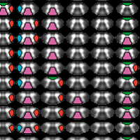 Vanderbilt University