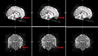 Vanderbilt University