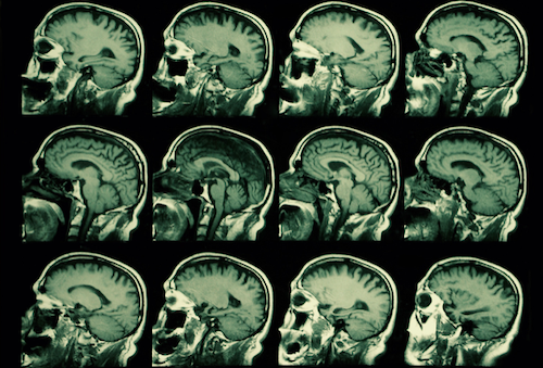 Vanderbilt University