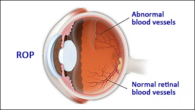 Vanderbilt University