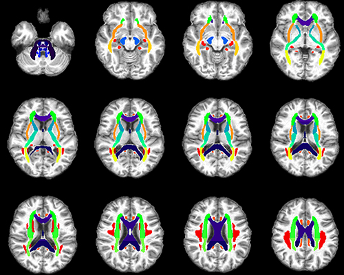 Vanderbilt University