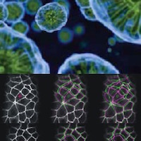 Vanderbilt University