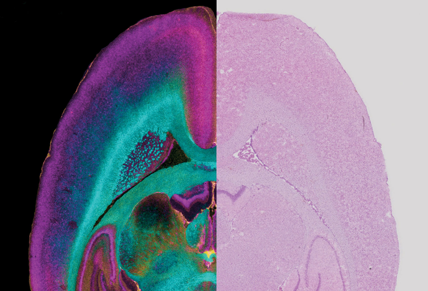 High-spatial resolution mass spectroscopy reveals in bold colors the distribution and concentration of different lipids based on their molecular weight in a rat brain. (IMAGE COURTESY OF PROFESSOR RICHARD M. CAPRIOLI)