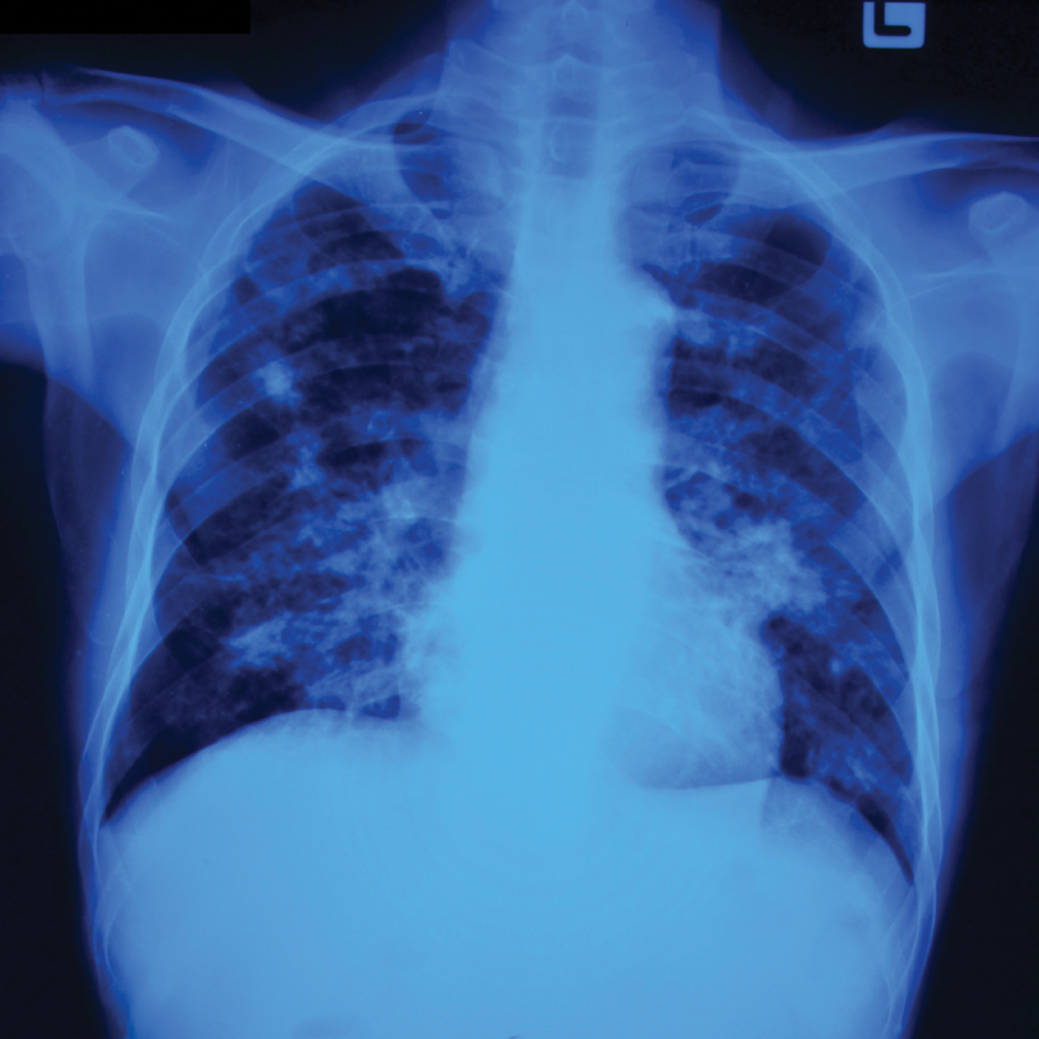 Vanderbilt University