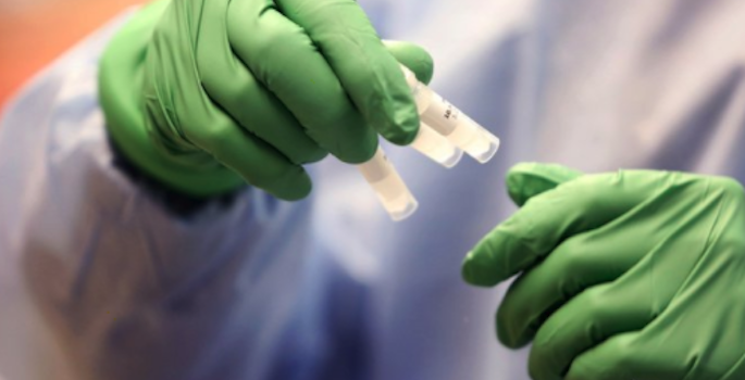 Close up of person wearing protective gown and green gloves holding three small vials.