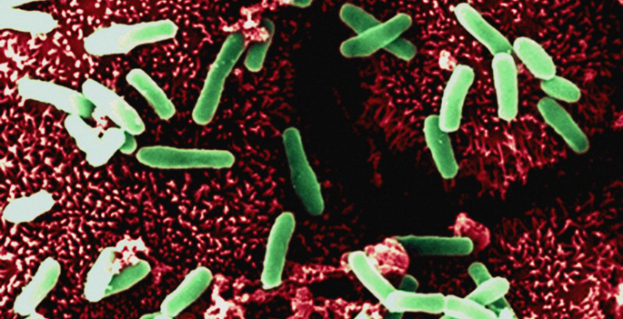 Vanderbilt University