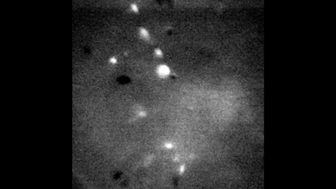 Imaging of neurological activity during normal activity