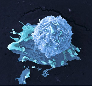 (Photo credit: Wellcome Images)