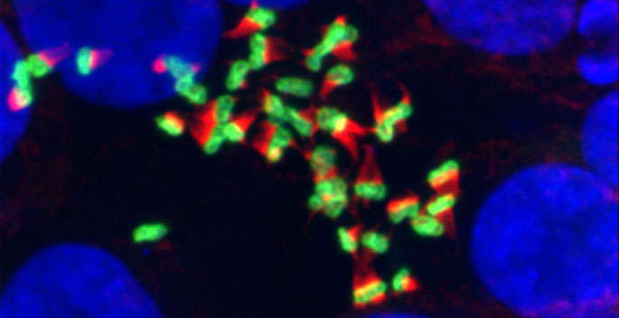 Vanderbilt University