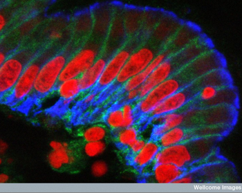 Vanderbilt University