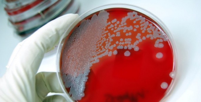 Vanderbilt University