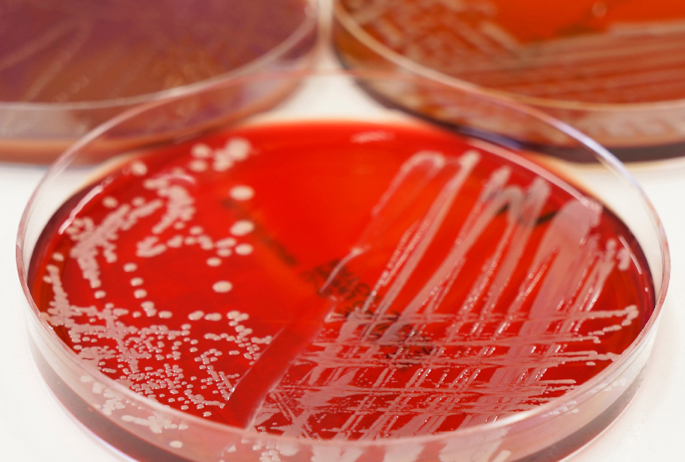 Vanderbilt University