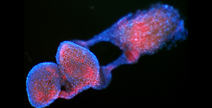 red blob surrounded by blue outline