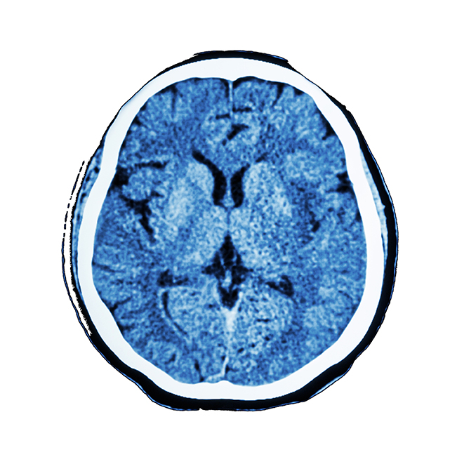 Vanderbilt University