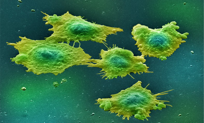 Vanderbilt University