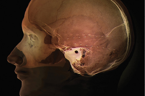 Vanderbilt University