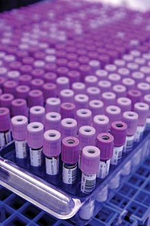 scripps-bloodSamples