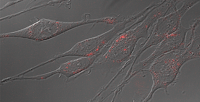 Neurons with serotonin transporters labeled with quantum dots. (Jerry Chang / Vanderbilt)