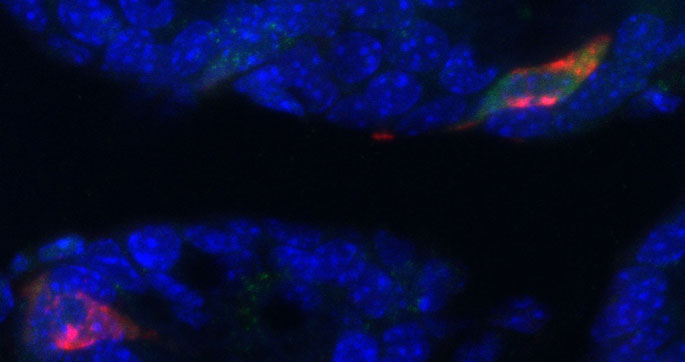 Vanderbilt University