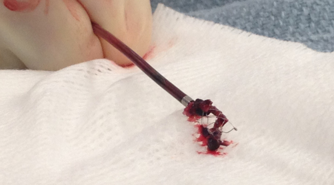 Vanderbilt University