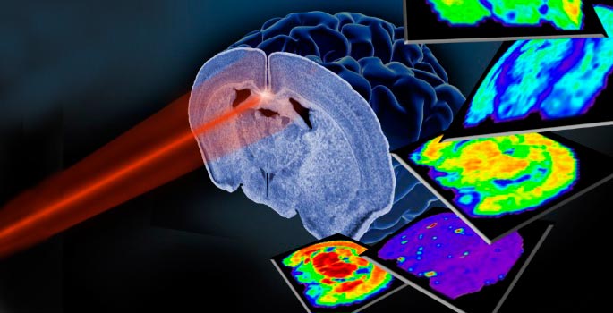 Imaging Mass Spectometry