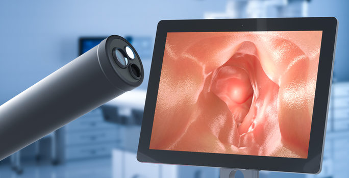 colonoscopy endoscope