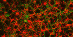 colored representation of cells and glia