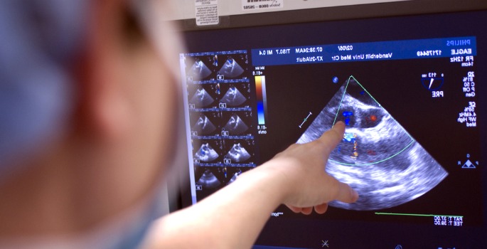 TEE tool at Vanderbilt used to monitor patients before and after surgery