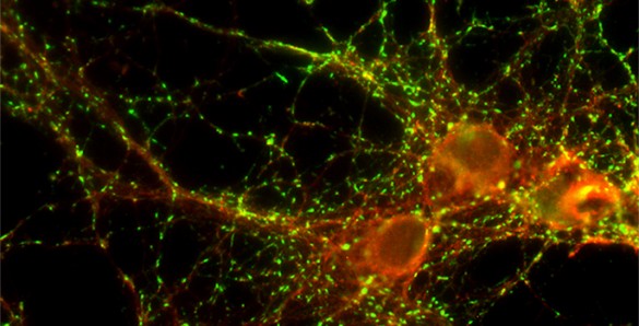Neuralnetworkfea Red blobs with many long thin green hairs
