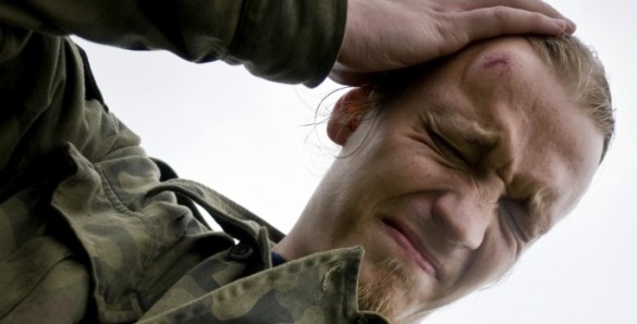 head-injury Head Injury