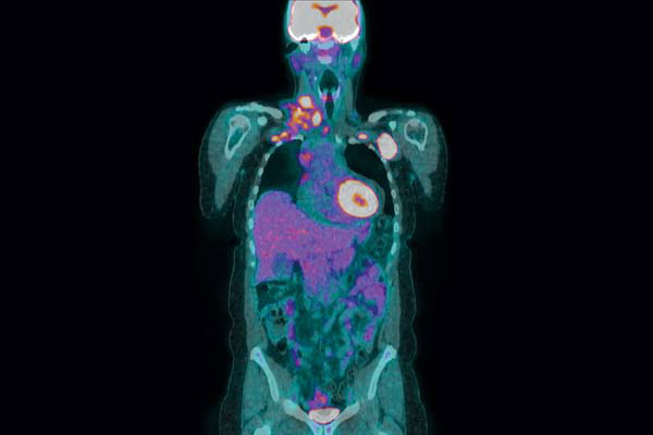 Vanderbilt University