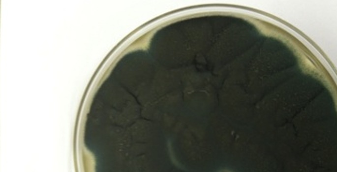 aspergillus culture