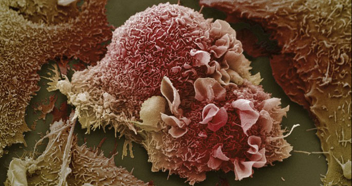 Vanderbilt University