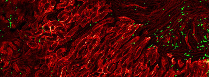 Vanderbilt University