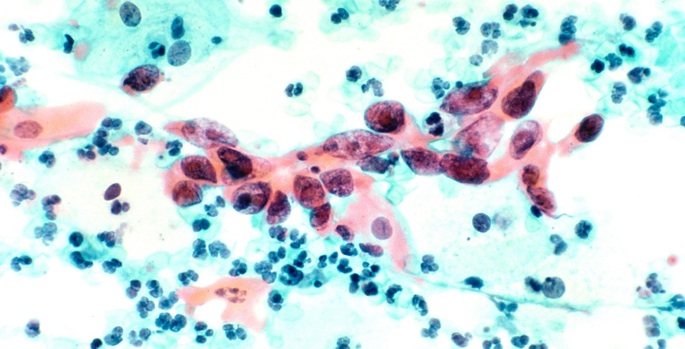 Vanderbilt University