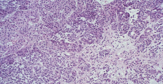 Vanderbilt University