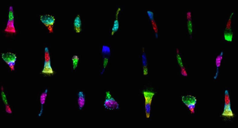 Vanderbilt University