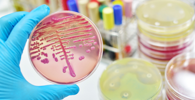 Colony of bacteria in red culture material on petri dish held by hand wearing blue glove with other petri dish samples and test tubes in the background