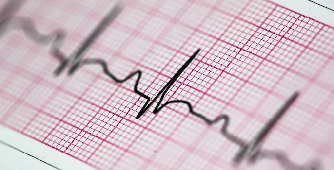 Up close photo of an electrocardiogram reading