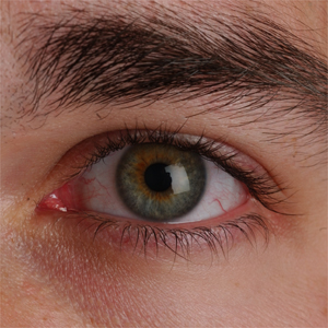 Vanderbilt University