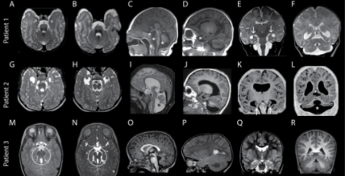 Vanderbilt University