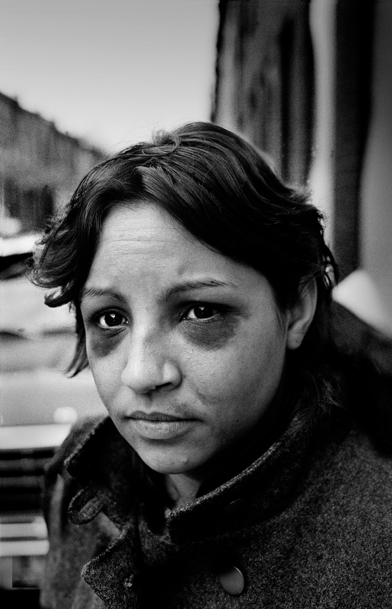 Close-up of woman with two black eyes