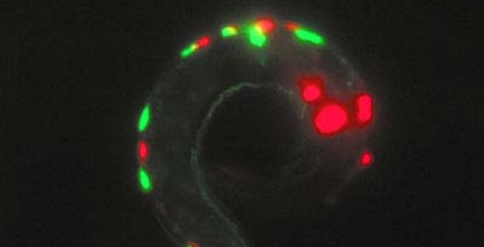 Vanderbilt University