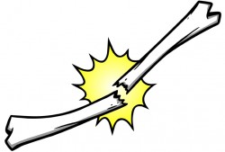 bone fracture_iStock